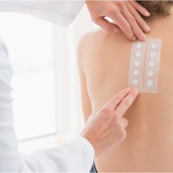 Patch test