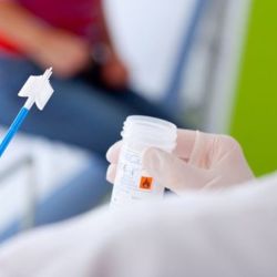 HPV test (papilloma virus)